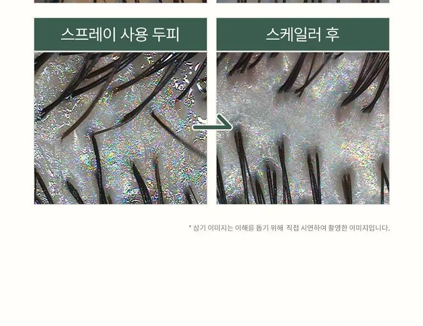 [두피 스케일링]피지/각질/냄새 전문가케어 솔랩 아쿠아픽 두피스케일러 250ml + 브러쉬 기획 상세페이지 22